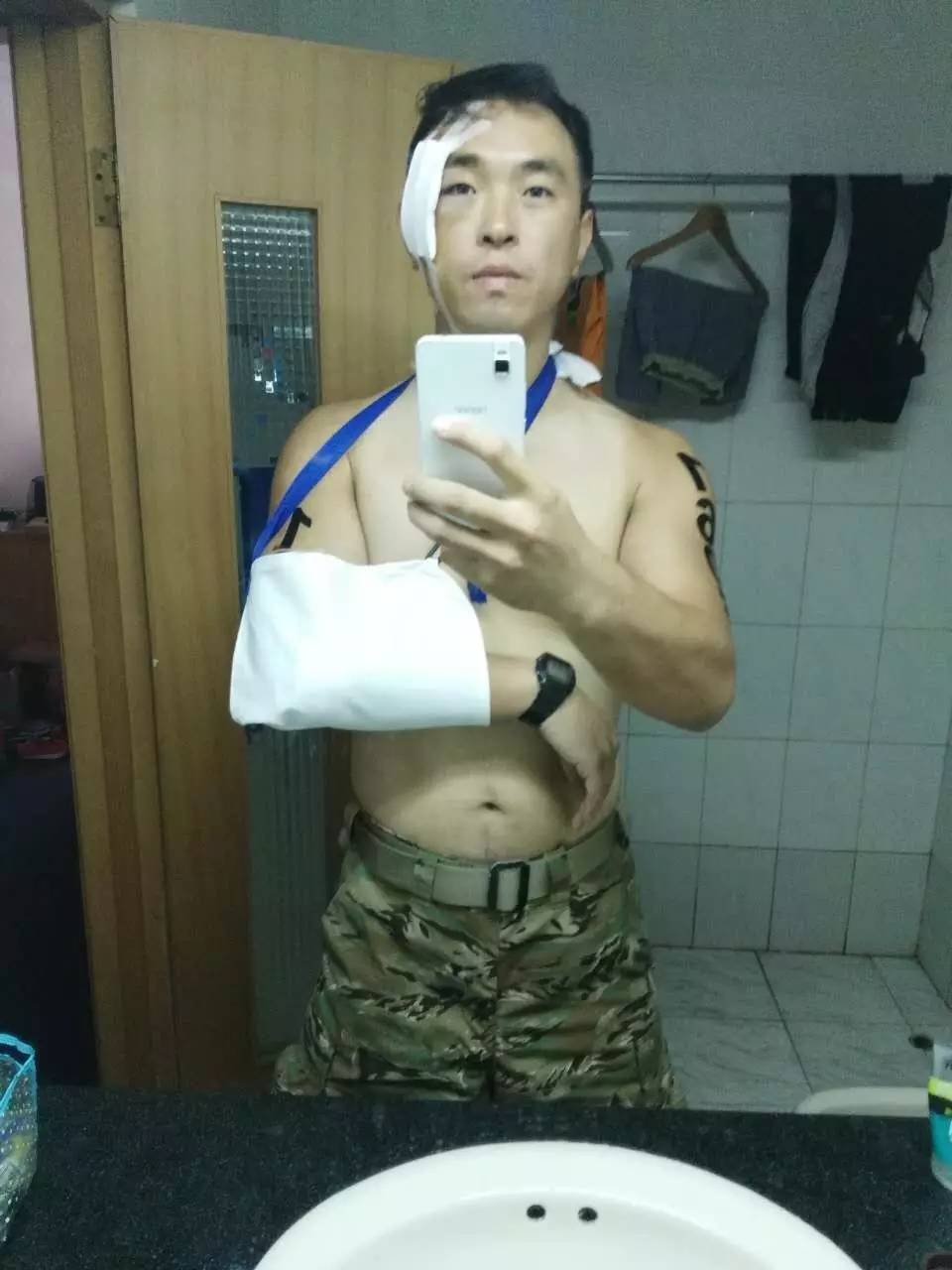 传递正能量：即使受了伤，也无法阻挡他们继续打铁的脚步