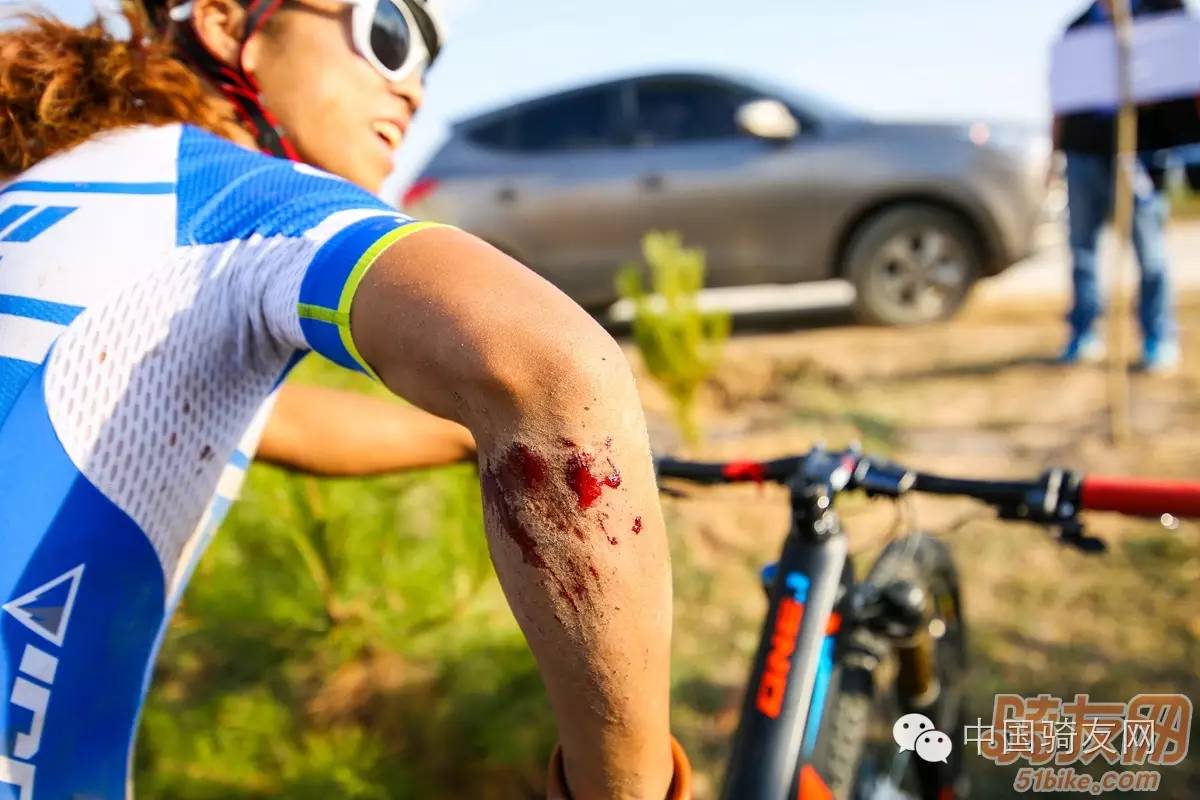赛事前瞻--2016中国山地自行车公开赛亮马台站