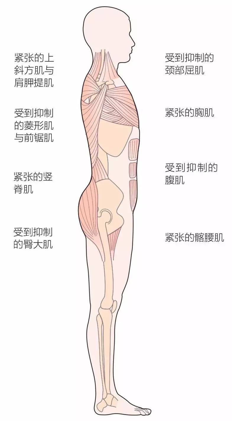 对症下药，铁三运动员常见的运动功能障碍
