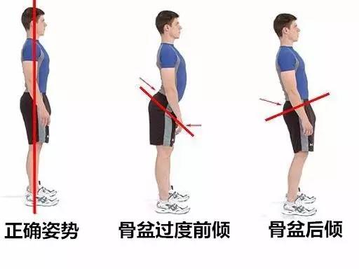 什么会导致骨盆前倾？纠正跑姿这里都有说
