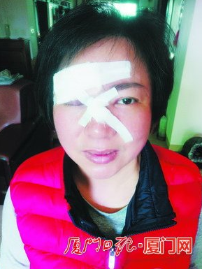 共享单车厦门理赔首案：刹车失灵女子摔破脸