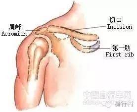 必读，自行车尺寸导致的5种运动损伤！