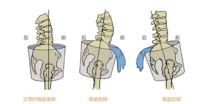 为什么骑自行车的人容易腰疼？