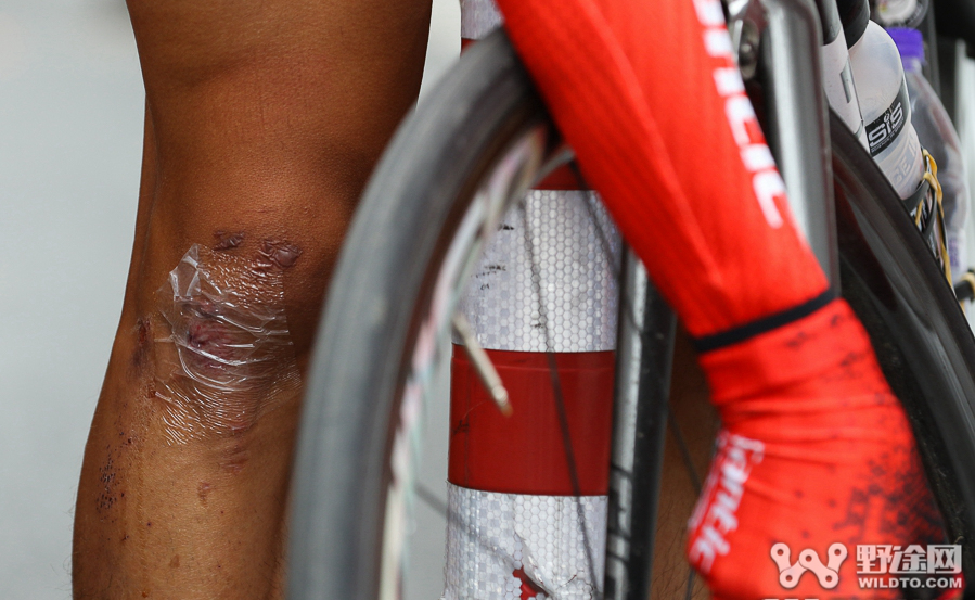 骑自行车膝盖疼  你可能患上髂胫束综合征