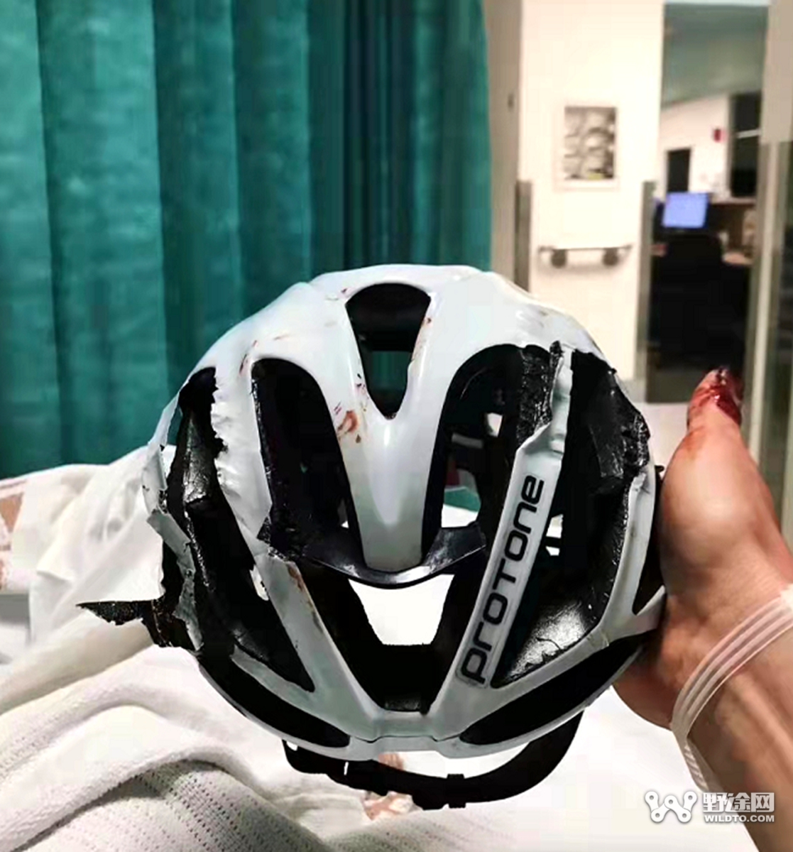 自行车头盔究竟有没有使用年限？