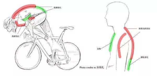 骑行常见伤痛该如何调整？听听医学专家怎么说