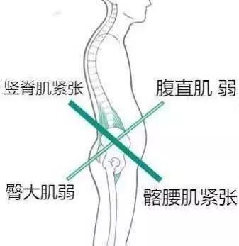 骑行常见伤痛该如何调整？听听医学专家怎么说