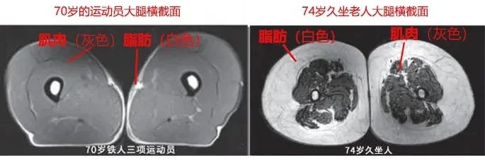 運動是加速衰老，還是延緩衰老？真相被揭開